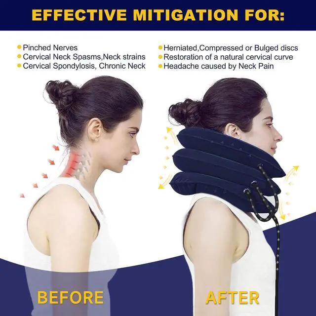Alt view image 4 of 6 - Neck Stretcher, Cervical Traction Device, Neck Traction Device for Neck Pain Relief, Adjustable Inflatable Neck Stretcher Cervical Traction and Neck Brace, Neck Decompression Home Use (Blue)