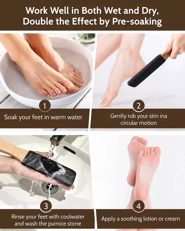 Alt view image 4 of 7 - Pumice Stone Foot File, 4pcs Set Callus Remover for Feet with Wooden Handle, Pedicure Foot Scrubber to Remove Dead Skin, Dry, Rough, Corns Skin Scraper