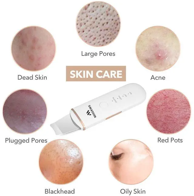 Alt view image 3 of 7 - Skin Scrubber Face Skin Spatula Facial Scrubber Spatula for Deep Cleansing Blackhead Remover Pore Cleaner with 4 Modes (White)