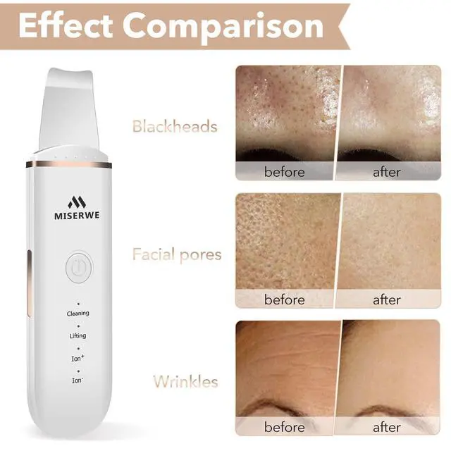 Alt view image 4 of 7 - Skin Scrubber Face Skin Spatula Facial Scrubber Spatula for Deep Cleansing Blackhead Remover Pore Cleaner with 4 Modes (White)