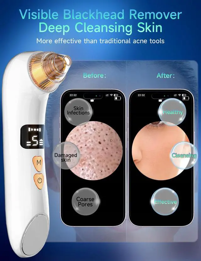 Alt view image 2 of 7 - Visible Blackhead Remover Pore Vacuum,5 Suction Levels,6 Probes,Heating Facial Deep Cleansing,6MP HD Camera 25X Magnification Facial Pore Acne,Comedone Whitehead Extractor Tools for Women Men