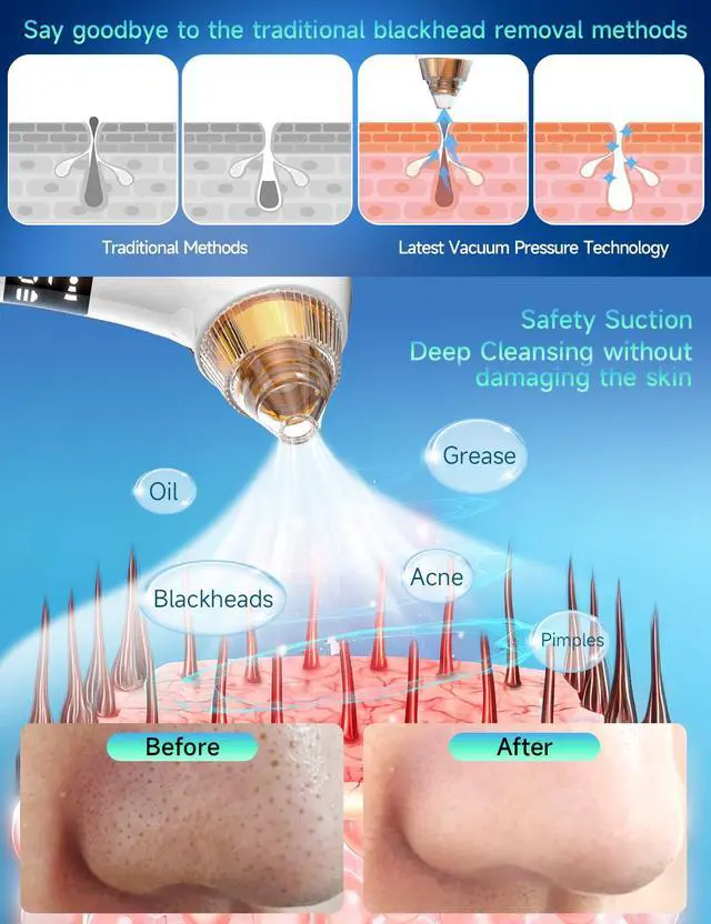 Alt view image 3 of 7 - Visible Blackhead Remover Pore Vacuum,5 Suction Levels,6 Probes,Heating Facial Deep Cleansing,6MP HD Camera 25X Magnification Facial Pore Acne,Comedone Whitehead Extractor Tools for Women Men
