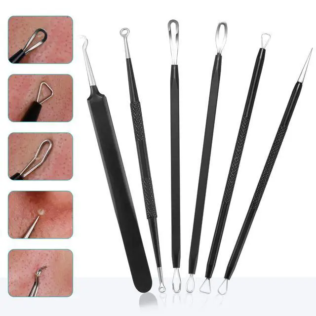 Alt view image 2 of 7 - Blackhead Remover Pimple Popper Tool Kit - (6 Piece Kit) - Professional Stainless Pimples Comedone Extractor Removal Tool