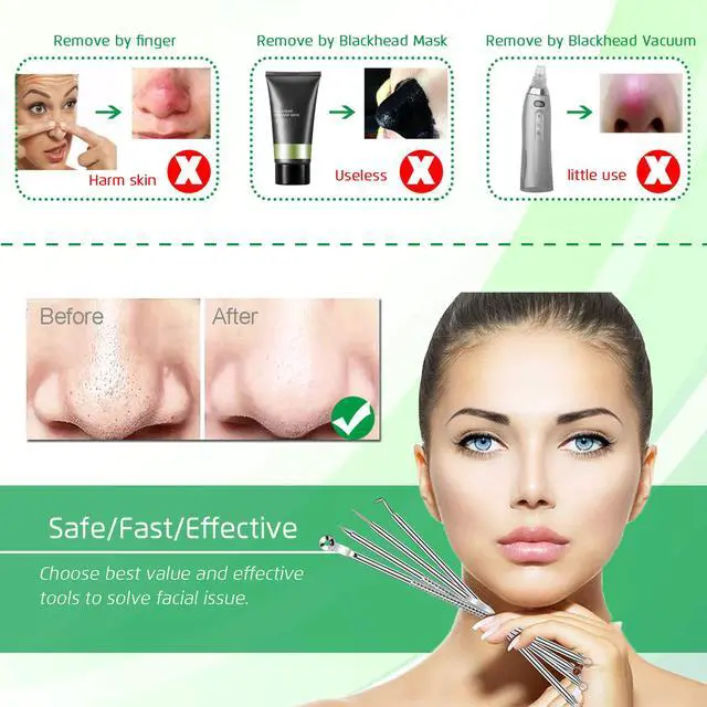 Alt view image 2 of 7 - 5PCS Blackhead Remover Comedone Extractor, Curved Blackhead Tweezers Kit, Professional Stainless Pimple Acne Blemish Removal Tools Kit for Manual