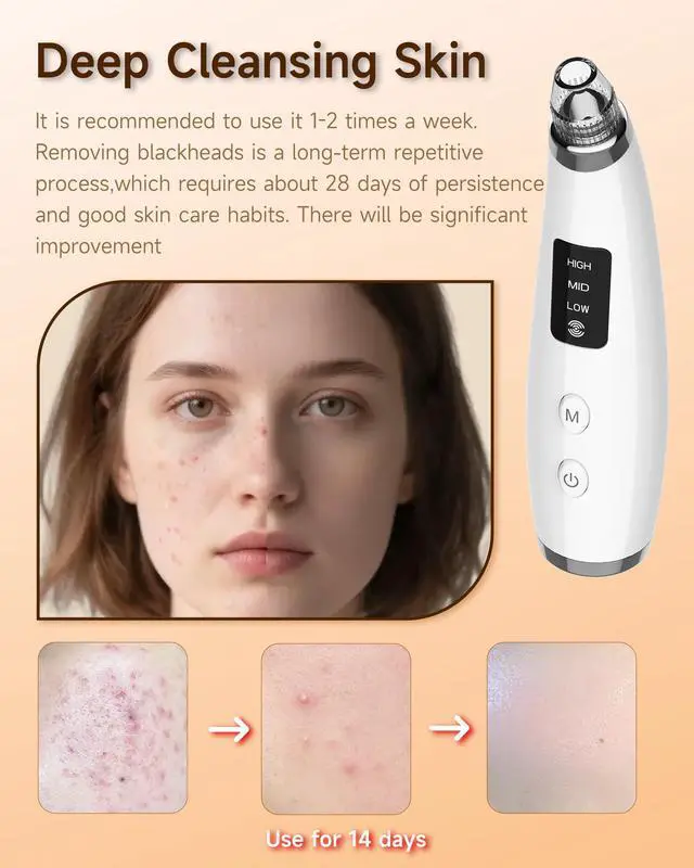 Alt view image 4 of 7 - Blackhead Remover Vacuum, Type-C Rechargeable Pore Cleaner with 3 Adjustable Suction, 6 Probes & Comedone Extractor Tool Kit for Women and Men, White Heads Removal for Face & Nose (White)