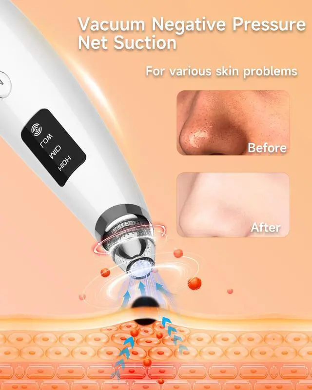Alt view image 3 of 7 - Blackhead Remover Vacuum, Type-C Rechargeable Pore Cleaner with 3 Adjustable Suction, 6 Probes & Comedone Extractor Tool Kit for Women and Men, White Heads Removal for Face & Nose (White)