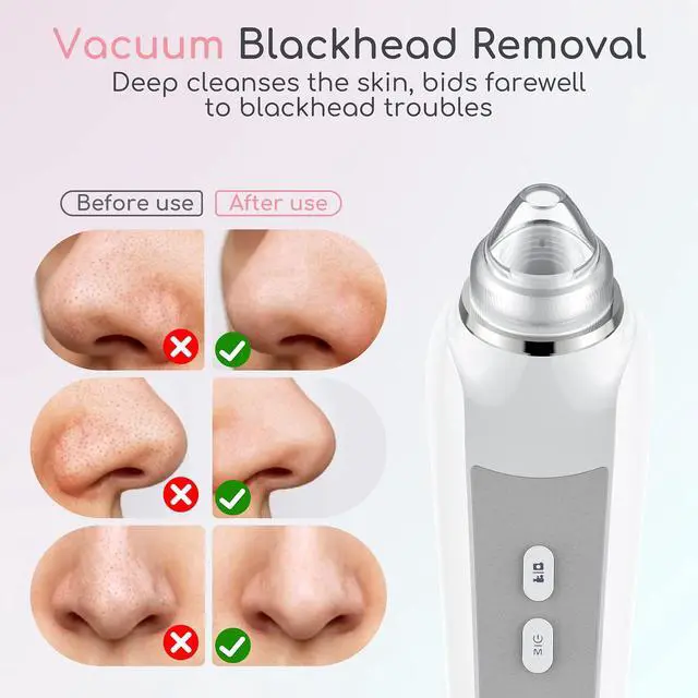 Alt view image 5 of 7 - Blackhead Remover Vacuum, Black Head Remover for Face with Camera, Pore Vacuum for Men and Women, USB Interface Type Blackhead Remover Tools, 6 Suction Heads & 3 Adjustment Modes (Grey)