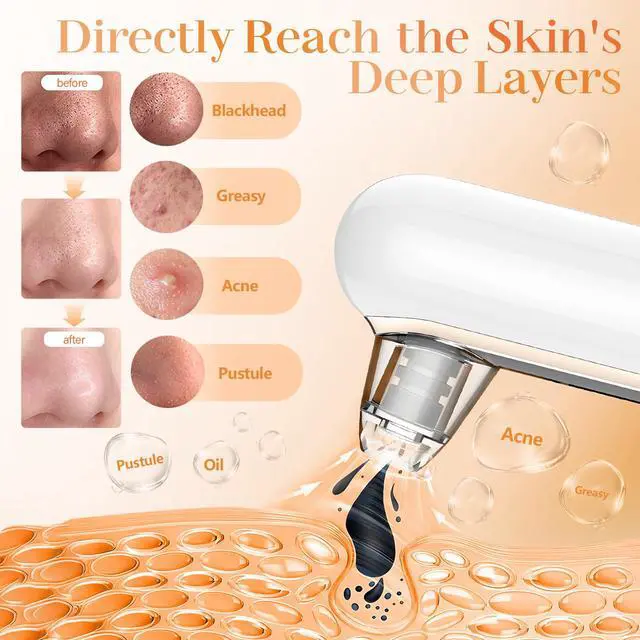 Alt view image 3 of 6 - Blackhead Remover Vacuum Blackhead Vacuum Remover Pore Extractor Blackhead Remover Tool Black Head Remover for Face Blackhead Extractor Pore Cleaner Vacuum with USB Charge 4 Modes 5 Suction Heads