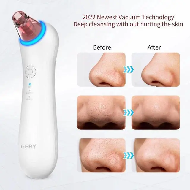 Alt view image 2 of 7 - Blackhead Remover Vacuum Pore, Black Head Remover for Face Pimple Skin Cleaner Tools Kit, Electric Comedone Facial Whitehead Extractor with Red & Blue Light, 3 Suction Levels 4 Probes