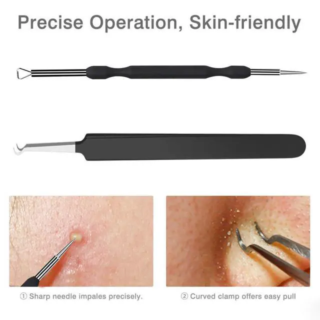 Alt view image 4 of 5 - Blackhead Remover Tool Comedones Extractor Acne Removal Kit for Blemish, Whitehead Popping, 6 Pcs Zit Removing for Nose Face Tools with a Leather Bag (Black)