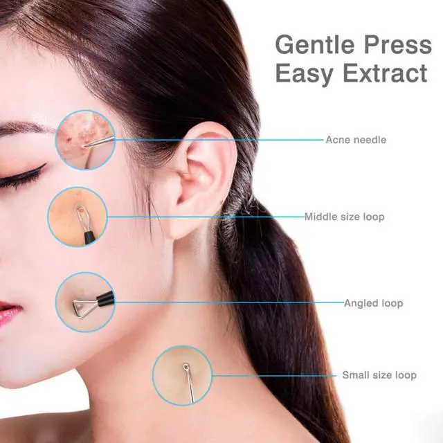 Alt view image 5 of 5 - Blackhead Remover Tool Comedones Extractor Acne Removal Kit for Blemish, Whitehead Popping, 6 Pcs Zit Removing for Nose Face Tools with a Leather Bag (Black)