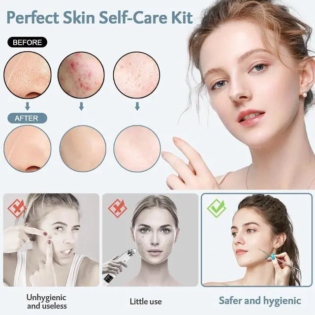 Alt view image 2 of 6 - Blackhead Remover Tools 10Pcs Pimple Popper Tool Kit, Blackhead Remover Extractor Tools, Anti-Slip Handle Pimple Comedone Extractor Acne Kit for Blackhead,Blemish,Zit Whitehead