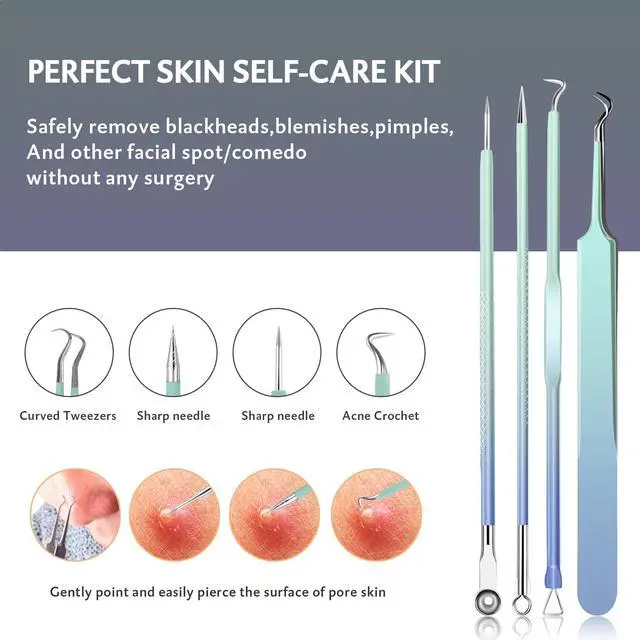 Alt view image 5 of 6 - Blackhead Remover Tools 10Pcs Pimple Popper Tool Kit, Blackhead Remover Extractor Tools, Anti-Slip Handle Pimple Comedone Extractor Acne Kit for Blackhead,Blemish,Zit Whitehead