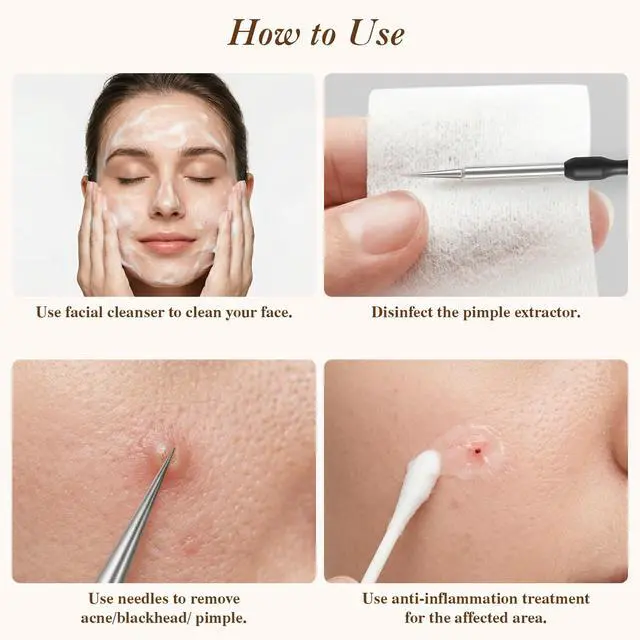 Alt view image 7 of 7 - 6 Pcs Pimple Extractor Tool Kit, Stainless Blackhead Remover Tools, Professional Comedone Pimple Popper Tools with Leather Bag