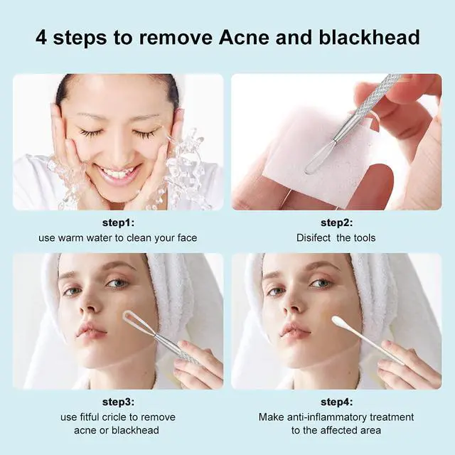 Alt view image 4 of 6 - Professional Blackhead and Blemish Remover -Pimple Comedone Removal 2-in-1 Extractor Tool