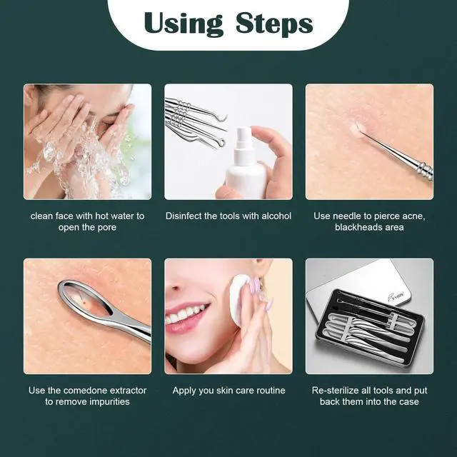 Alt view image 5 of 7 - Blackhead and Acne Extractor Kit, Professional Pimple Popper Tool Kit, Acne Tweezers and Blackhead Remover Tools for Face, 6 PCS Surgical Extractor Pimple Popping Tools
