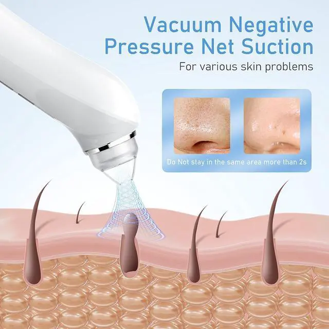 Alt view image 3 of 6 - Blackhead Remover Vacuum, USB Interface Type Pore Vacuum, Black Head Extractions Tool with Camerafor, Men and Women Pore Cleaner, 3 Adjustment Modes & 6 Suction Heads(Light Pink)