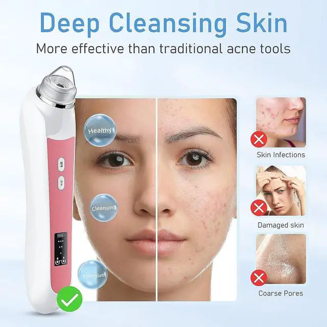 Alt view image 4 of 6 - Blackhead Remover Vacuum, USB Interface Type Pore Vacuum, Black Head Extractions Tool with Camerafor, Men and Women Pore Cleaner, 3 Adjustment Modes & 6 Suction Heads(Light Pink)