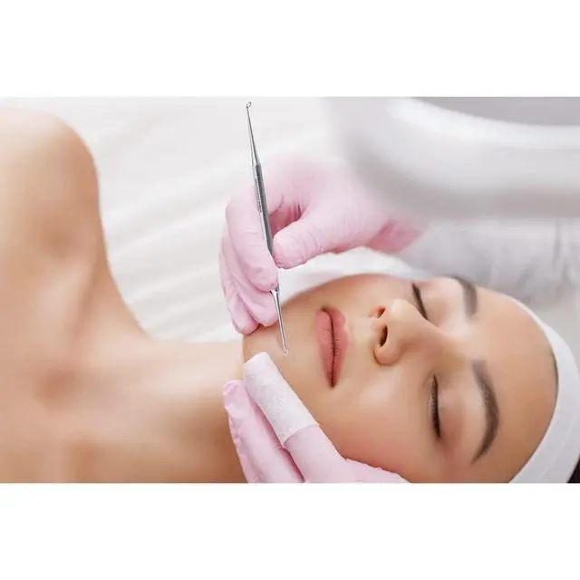 Alt view image 3 of 4 - Blackhead Remover Comedone Extractor Tool - Dual Loop Whitehead Blemish Acne Removal - Skin, Facial, Pimple, German Stainless Steel