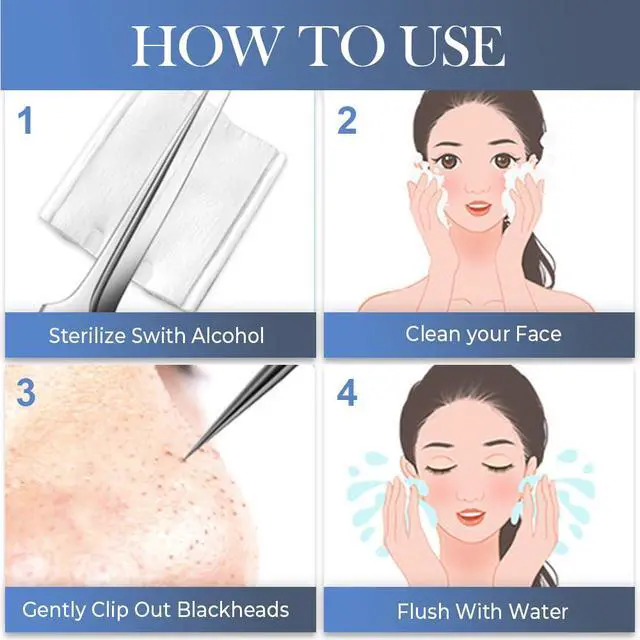 Alt view image 7 of 7 - 2026 Medical Grade Blackhead Extraction Tool Kit, Professional Facial Blackhead Remover Tweezers, Grade Extractor Tool for Removal Black Heads, Whiteheads, Pimples, Blemishes and Pimples