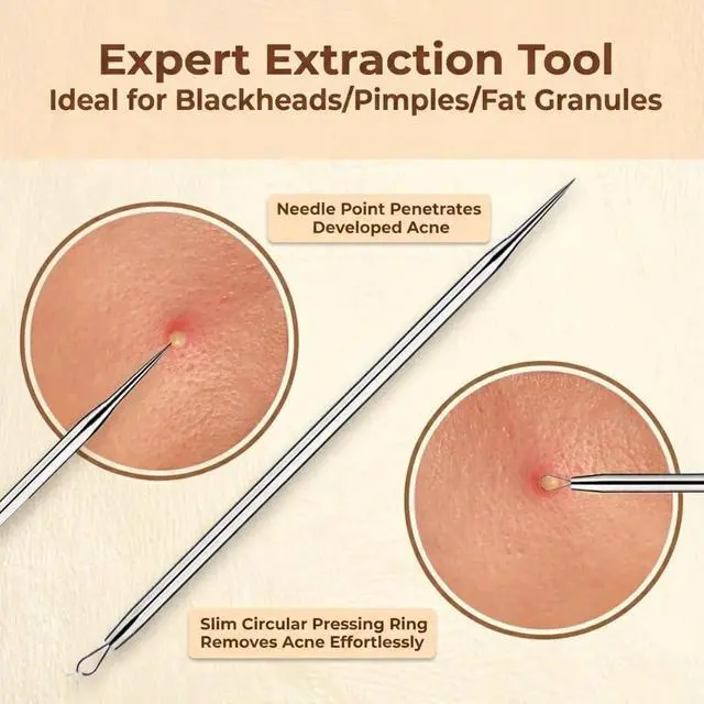 Alt view image 3 of 7 - 2 Pcs Pimple Extractor Tool 410 Grade Stainless Steel | Comedone Extractor, Pimple Popper, Blackhead Remover for Face, Zit Popper, Pimple Needle for Acne Removal