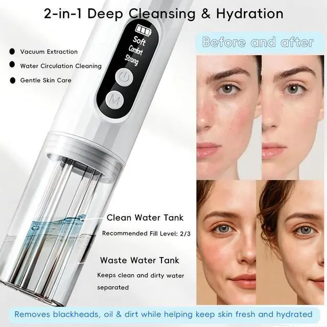 Alt view image 2 of 7 - Pore Vacuum Blackhead Remover, 2-in-1 Hydrating Facial Cleansing Tool, 3 Suction Levels, 6 Replaceable Heads, Deep Pore Cleaning for Blackheads & Blemishes