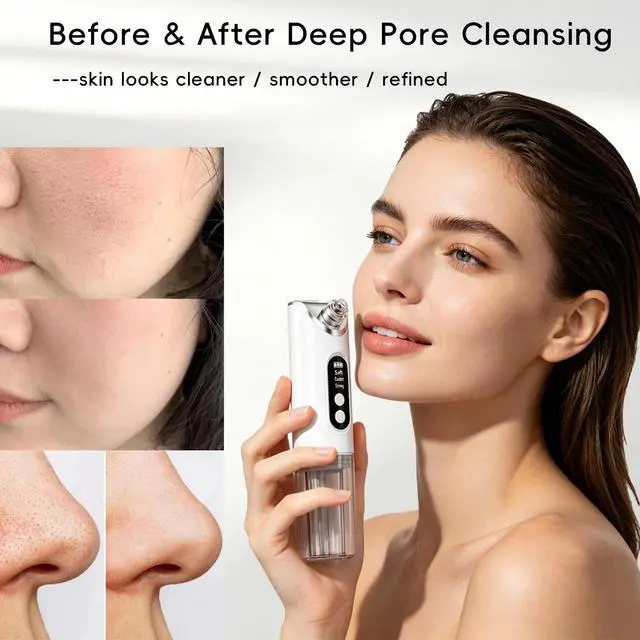 Alt view image 5 of 7 - Pore Vacuum Blackhead Remover, 2-in-1 Hydrating Facial Cleansing Tool, 3 Suction Levels, 6 Replaceable Heads, Deep Pore Cleaning for Blackheads & Blemishes