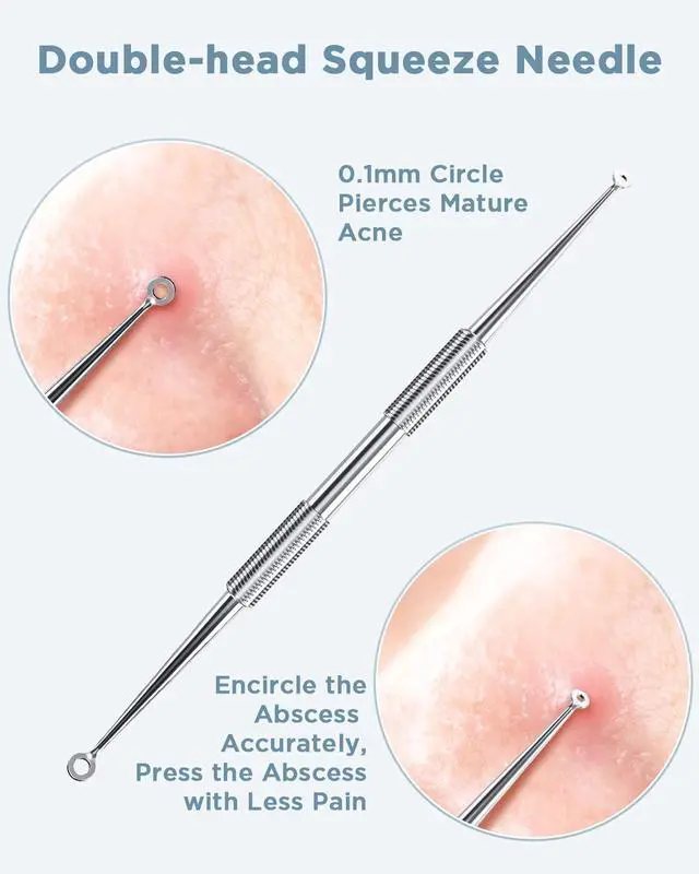Alt view image 5 of 5 - Blackhead Remover Blackhead Removal Pimple Comedone Extractor Tool - Treatment for Blemish Whitehead Popping Zit Removing with Metal Case (Silver)
