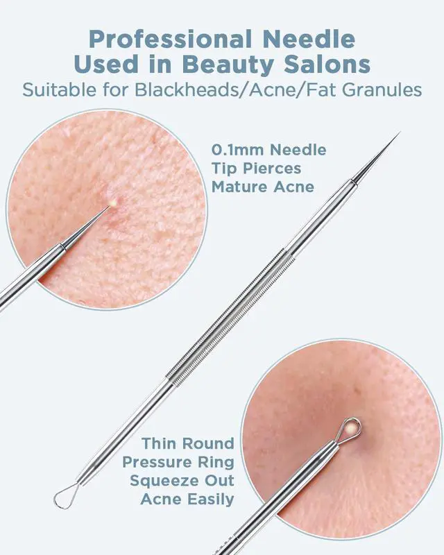 Alt view image 4 of 5 - Blackhead Remover Blackhead Removal Pimple Comedone Extractor Tool - Treatment for Blemish Whitehead Popping Zit Removing with Metal Case (Silver)