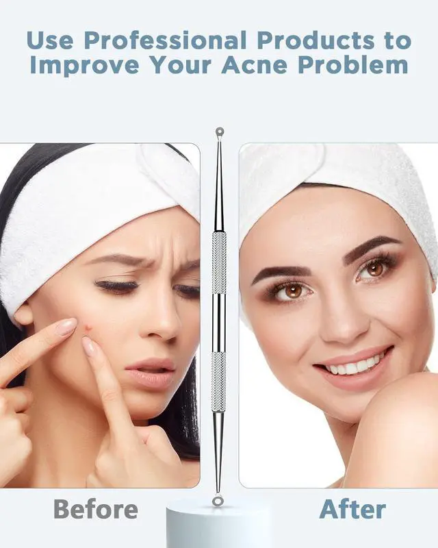 Alt view image 2 of 5 - Blackhead Remover Blackhead Removal Pimple Comedone Extractor Tool - Treatment for Blemish Whitehead Popping Zit Removing with Metal Case (Silver)