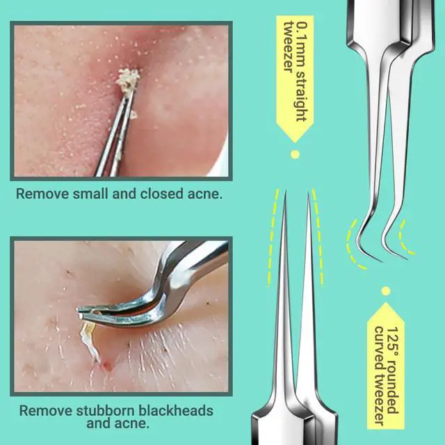Alt view image 3 of 7 - Blackhead Remover Tools and Ingrown Hair Tweezers, 9 pcs Pimple Popper Tool Kit, Ingrown Hair Removal Kit with Pimple Extractor, Pore Extractor, Tweezers, Razor