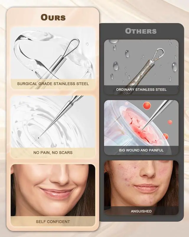 Alt view image 5 of 7 - Professional Facial Milia Removal Tool and Whitehead Extractor,Titanium Alloy Double Ended Needle and Steel Tweezers Kit,Blackhead,Blemish,Zit and Pimple Acne Remover Popper (Stainless Silver)