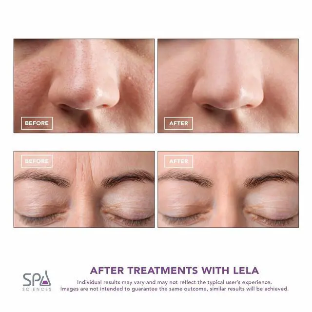 Alt view image 4 of 7 - 4-in-1 Facial Spatula for Deep Cleansing, Pore Extraction, Serum Infusion, Anti-Aging and Contouring