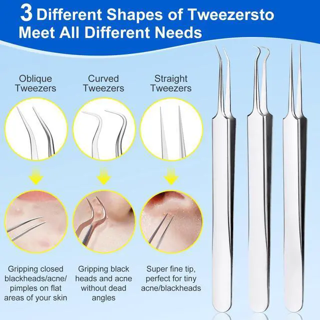 Alt view image 2 of 7 - Pimple Popper Tool Kit,10 Pcs Professional Blackhead Remover Comedones Extractor for Easy Removal for Pimples,Blackheads,Zit Removing, Facial and Nose, Acne Removal Kit with Metal Box (Silver)