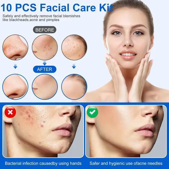 Alt view image 5 of 7 - Pimple Popper Tool Kit,10 Pcs Professional Blackhead Remover Comedones Extractor for Easy Removal for Pimples,Blackheads,Zit Removing, Facial and Nose, Acne Removal Kit with Metal Box (Silver)