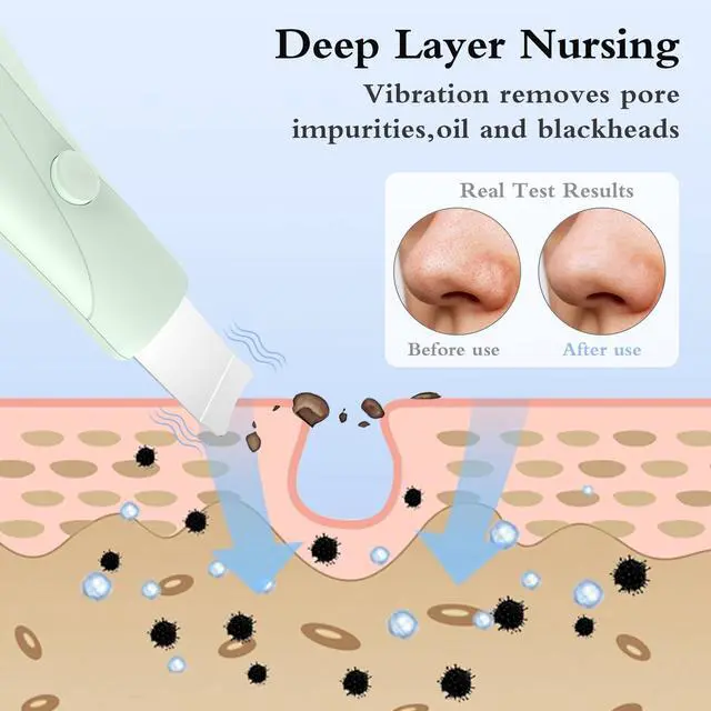 Alt view image 6 of 7 - Skin Scrubber Face Spatula Skin Spatula Pore Cleaner Blackhead Remover Tools for Facial Deep Cleansing Skin Care Tool for Men and Women (Green)