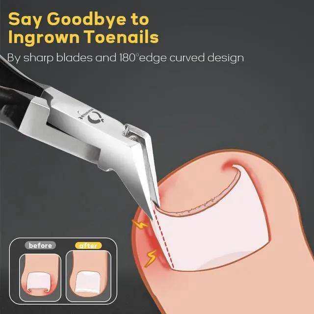 Alt view image 3 of 7 - Toenail Clippers, Professional Thick & Ingrown Nail Clippers for Men, Pedicure Clippers Toenail Cutter, Upgraded Toe Nail Clippers with Catcher and Non-Slip Handle
