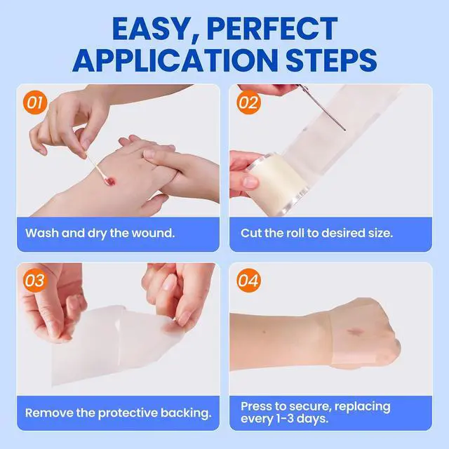 Alt view image 4 of 6 - Hydrocolloid Roll Large Adhesive Bandages Medical Grade Tape Wound Care Dressing, Acne Care, Bed Sore,Burn, Blister, Highly Absorbent for Sterile and Waterproof (2in x 5ft)