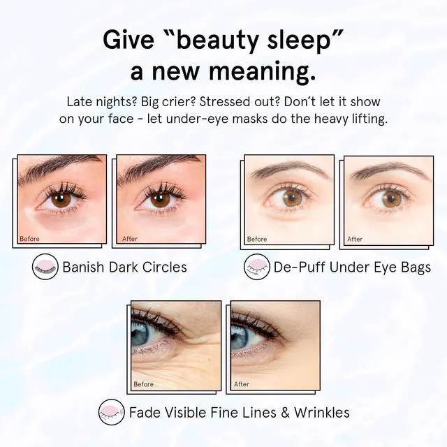 Alt view image 4 of 7 - grace & stella Retinol Under Eye Patches for Puffy Eyes and Dark Circles, Restoring Gel Under Eye Masks with Hyaluronic Acid - Vegan Cruelty-Free Skincare - Gifts for Teen Girls (Purple, 6 Pairs)