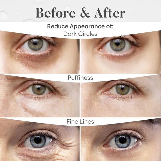 Alt view image 4 of 7 - BLOOMORA Variety Under Eye Patches (30 Pairs) - For Dark Circles & Puffiness - Eye Mask for Care