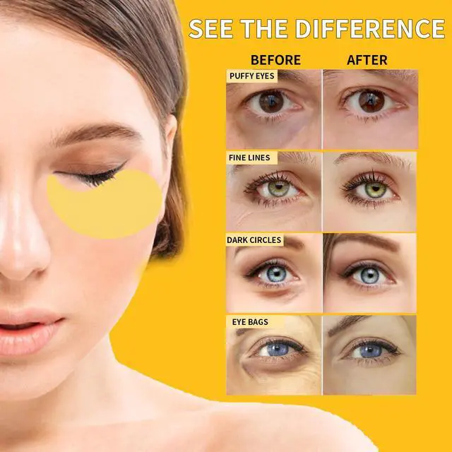 Alt view image 4 of 7 - 24K Gold Eye Masks for Dark Circles and Puffiness 70PCS, Under Eye Patches for Puffy Eyes Treatment, Under Eye Mask w/Caffeine, Hyaluronic Acid, Peptides for Eye Bags Treatment, Eye Mask Skincare