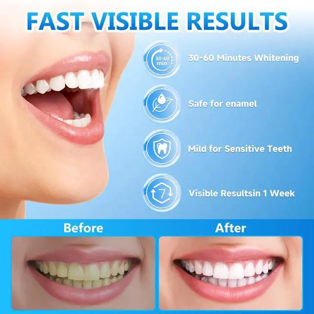 Alt view image 3 of 7 - Milumber Teeth Whitening Strips for Sensitive, 42 Strips Whitener Safe Whitestrip, Deep Stains Removal Tooth Whitening, Enamel Safe Non-Slip Dry Strip Technology for Whiter Teeth, Mint