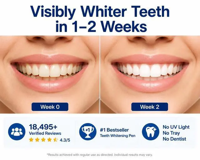 Alt view image 2 of 7 - VieBeauti Teeth Whitening Pen Kit, 35% Carbamide Peroxide Gel, 5 Pack