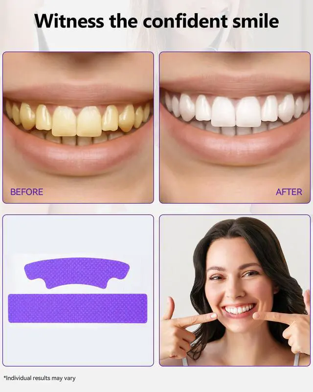 Alt view image 3 of 7 - Teeth Whitening Strips 14 Treatments, Enamel Safe for Sensitive Tooth, Whitens Teeth, Purple Whitening Strips, Removes Yellow Stains & Bad Breath - Effective Color Correction for a Brighter Smile
