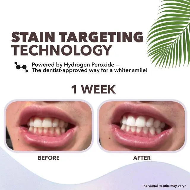 Alt view image 3 of 7 - Purli Professional Teeth Whitening Strips 9-Day Treatment Purli Whitening Strips for Sensitive People, Natural Coconut Oil, Professional Effects, Gum & Enamel Safe, Dry Strip