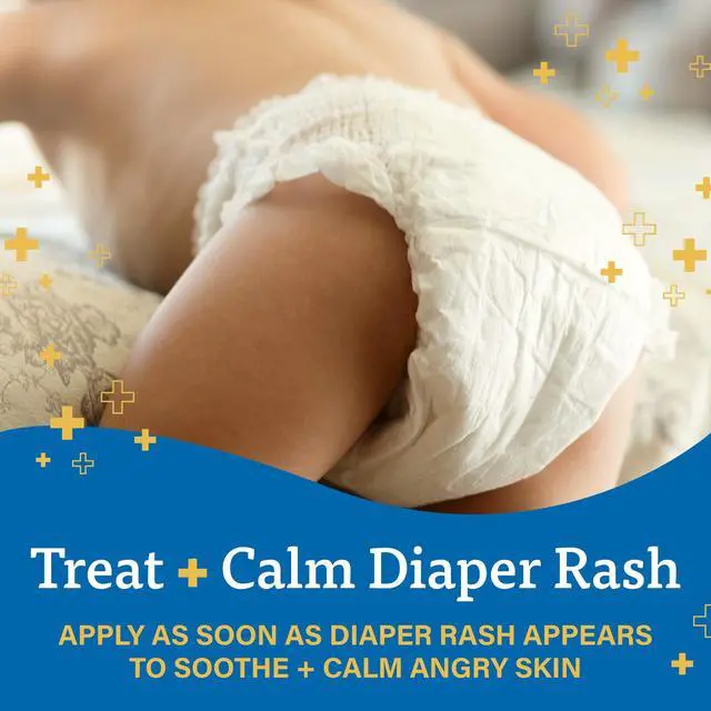 Alt view image 3 of 6 - A+D Zinc Oxide Diaper Rash Treatment Cream, Dimethicone 1%, Zinc Oxide 10%, Easy Spreading Baby Rash Cream, 4 Ounce Tube (Packaging May Vary)