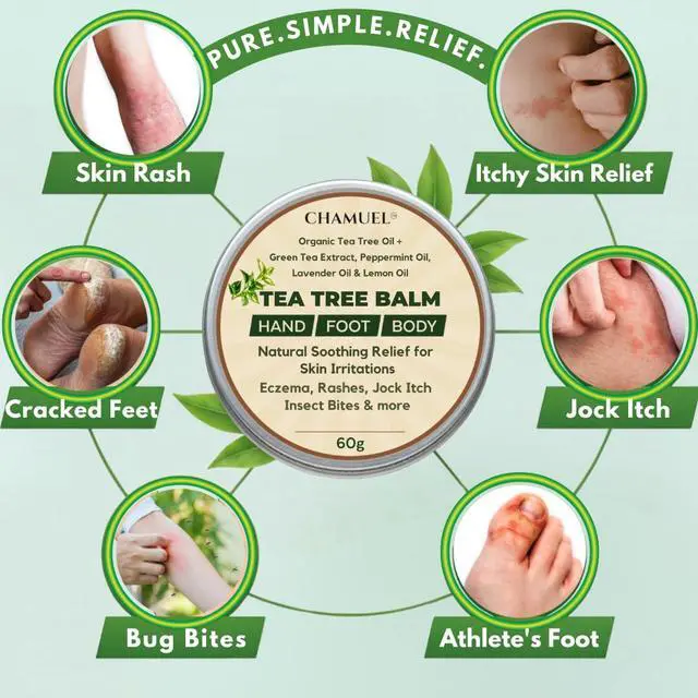 Alt view image 2 of 7 - Tea Tree Oil Balm, Itchy Skin Relief for Soothing Rashes, Jock Itch, Athletes Foot, Folliculitis, Bug Bites. Natural Formula for Dry Sensitive Skin | Safe for All Ages 1pack