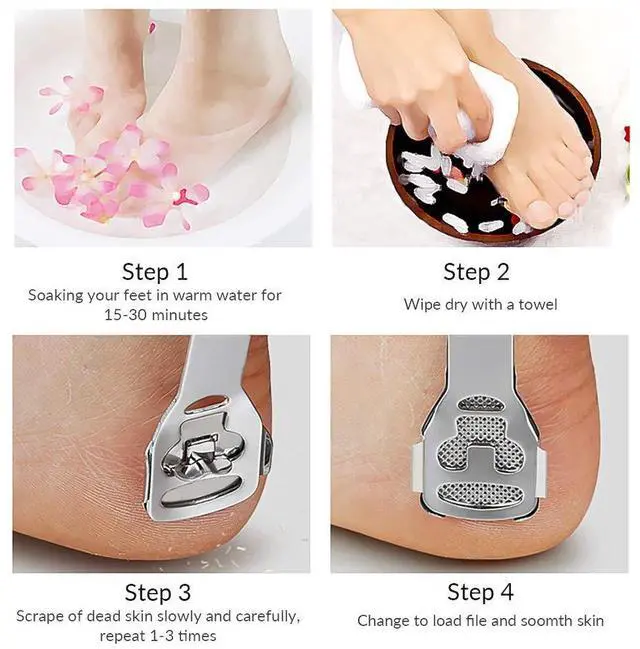 Alt view image 5 of 7 - Pedicure Callus Shaver Foot File Care Hard Skin Remover Sets with Case