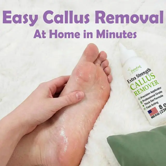 Alt view image 5 of 7 - Callus Remover for Feet (Extra Strength 8 oz) Foot Callus Remover Gel, Spa Foot Care, Pedicure Tools for Feet Scrubber
