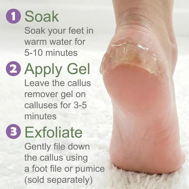 Alt view image 6 of 7 - Callus Remover for Feet (Extra Strength 8 oz) Foot Callus Remover Gel, Spa Foot Care, Pedicure Tools for Feet Scrubber